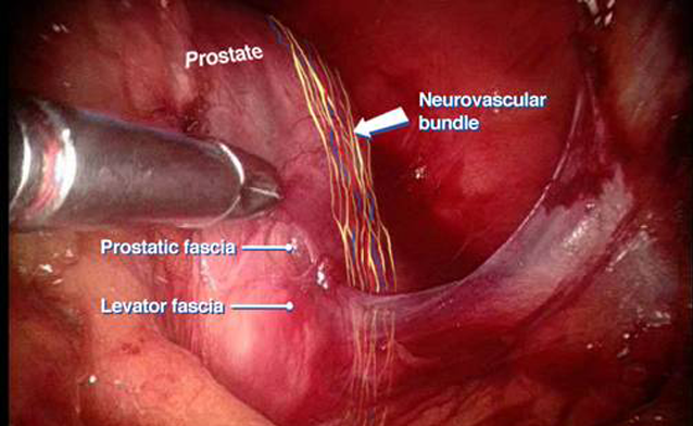 Gall Bladder Stone Removal Doctors